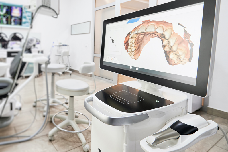 Intra-Oral Scanner in Davis