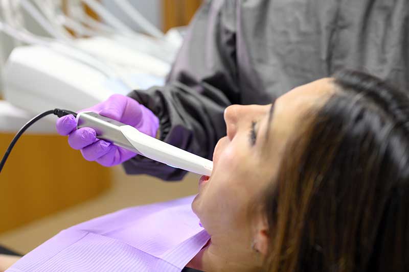 Intra-Oral Photography in Davis